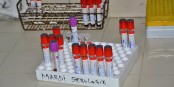Les sérologies montrent si une personne dispose d'anticorps ou pas. Foto: Happi Raphael / Wikimedia Commons / CC-BY-SA 4.0int